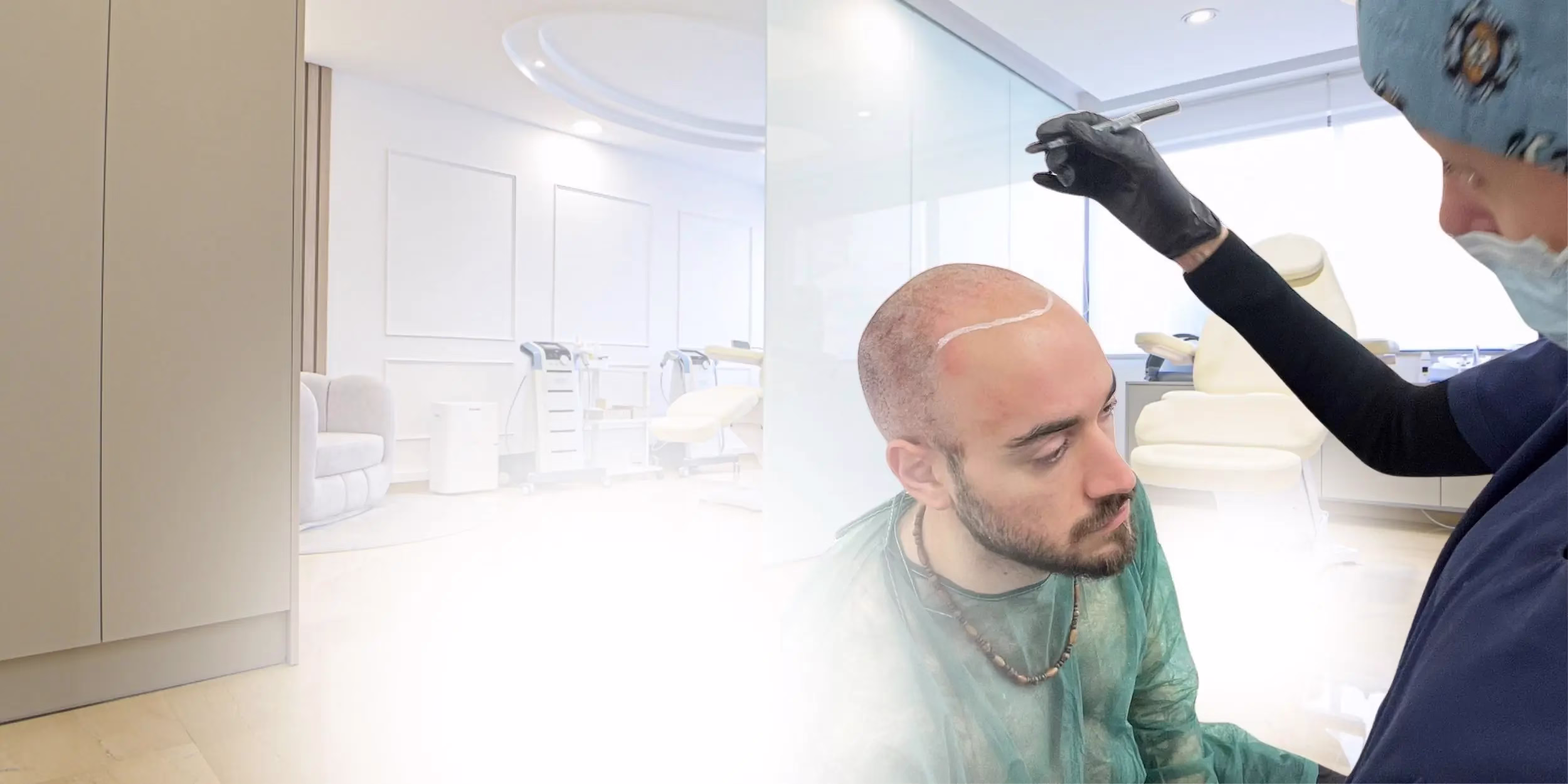 השתלת שיער ביוון